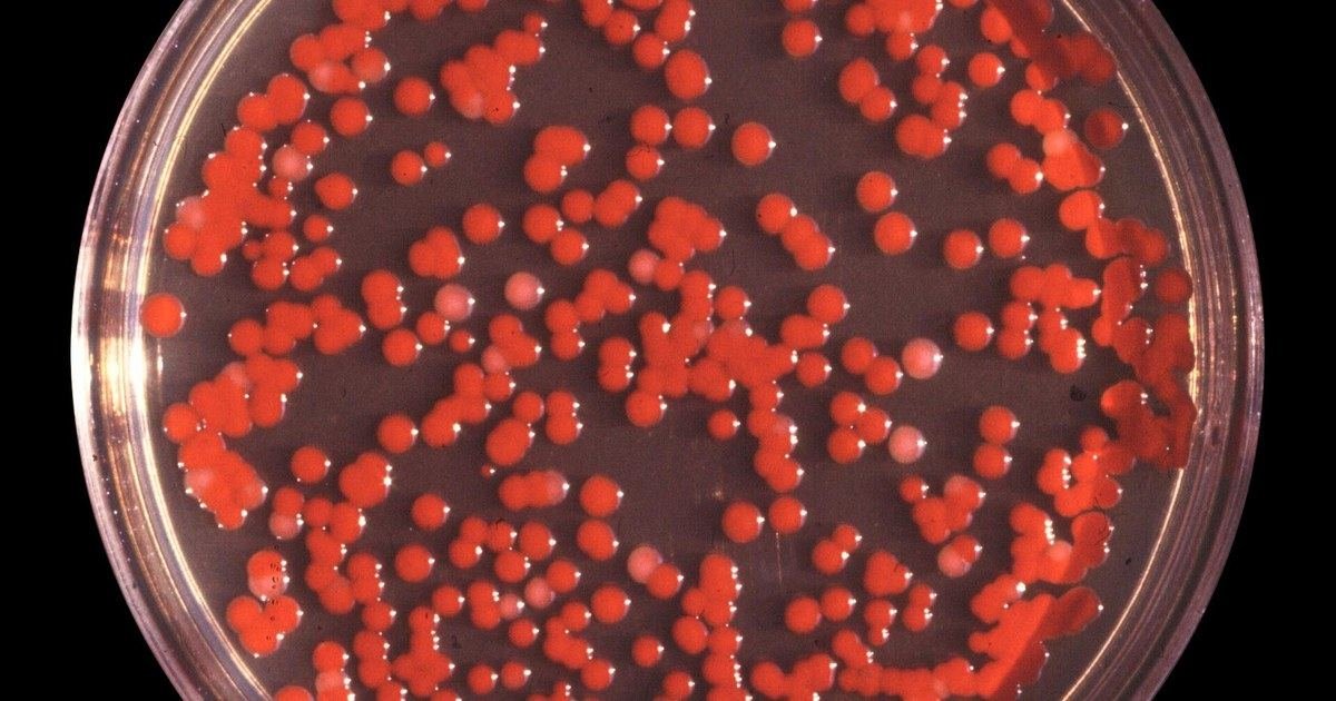 Brote de meningitis tras cirugías en un hospital de Mendoza: dos muertos, quirófanos cerrados y la bacteria que investigan