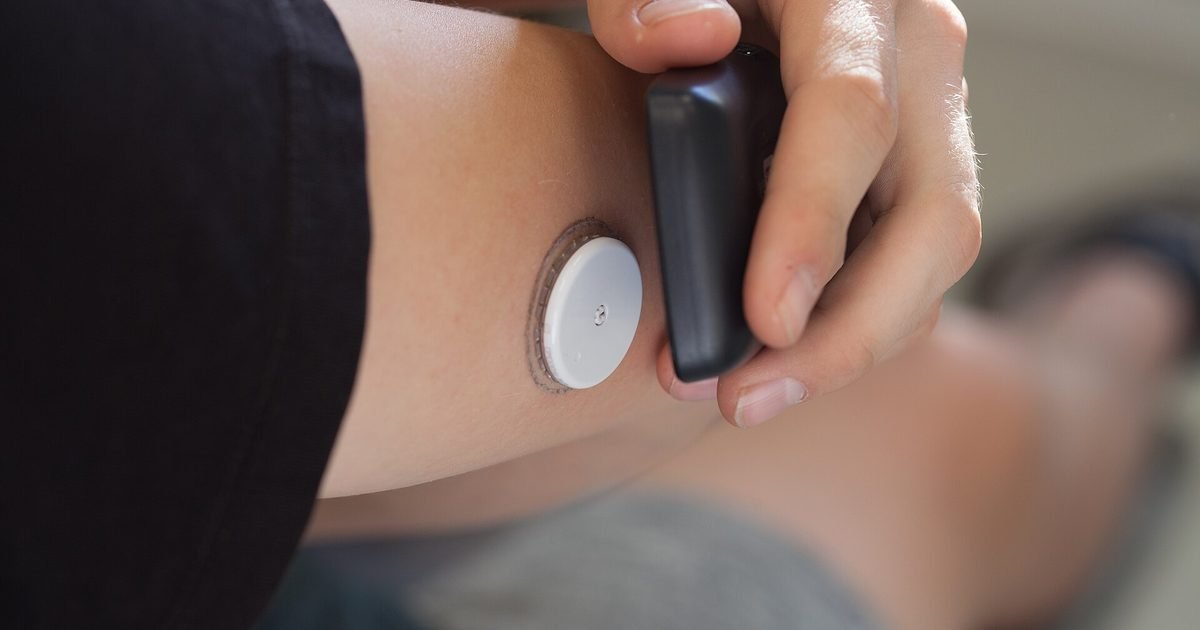 Glucose monitors on your arm: useful for everyone or only for people with diabetes?