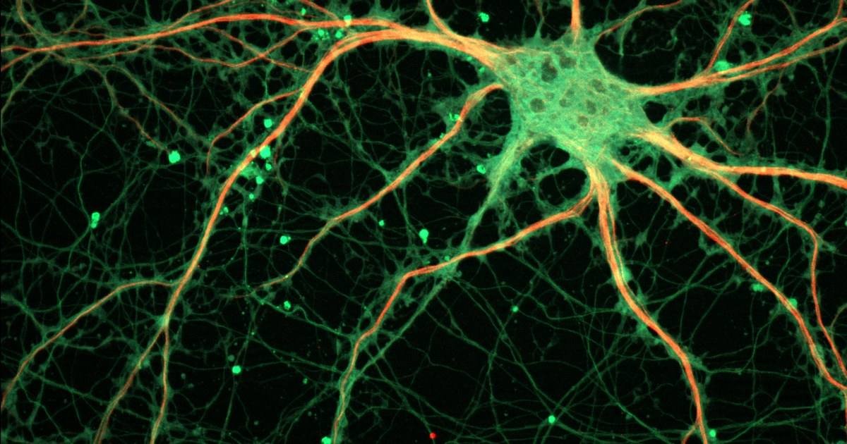 Hallan una proteína que protege la memoria al envejecer: lo que descubrieron (y lo que todavía no se sabe)